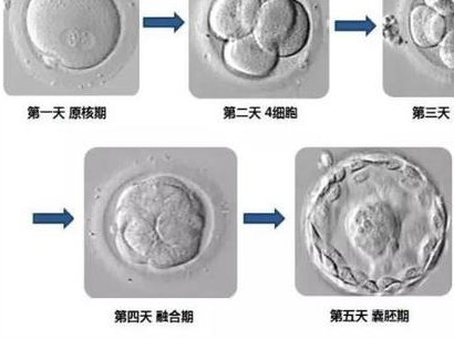 试管怀孕4周孕酮多少正常？ 试管怀孕期间如何判断胎儿是否健康？